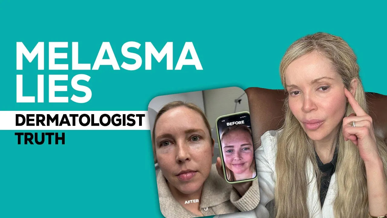 Melasma Explained: Why It Returns and How to Fix It at Home