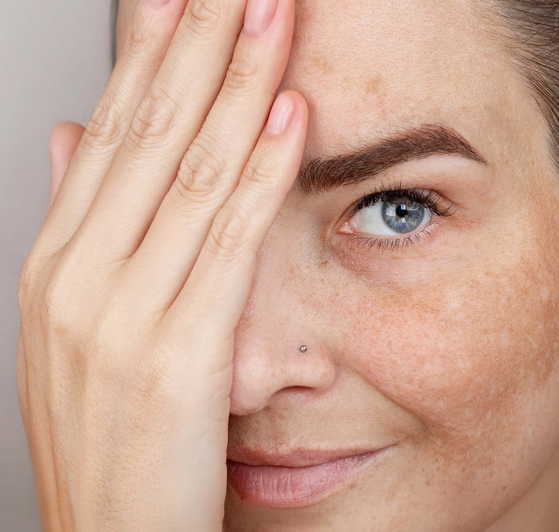 Close-up of a person with a hand covering one eye against a neutral background